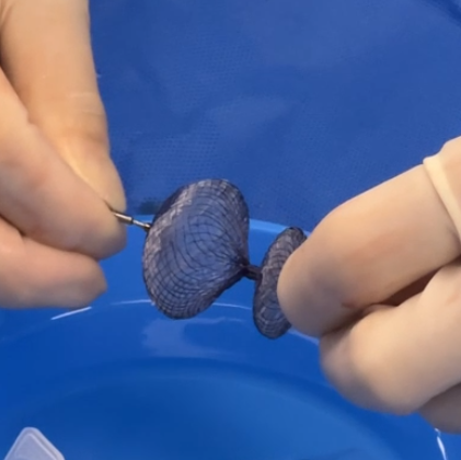 七旬老人突发脑梗、呼吸衰竭，竟因心脏多了一个「孔」！