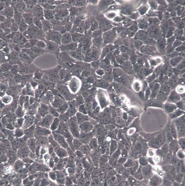 【MS751】MS751细胞/MS751细胞/MS751人子宫颈表皮癌细胞