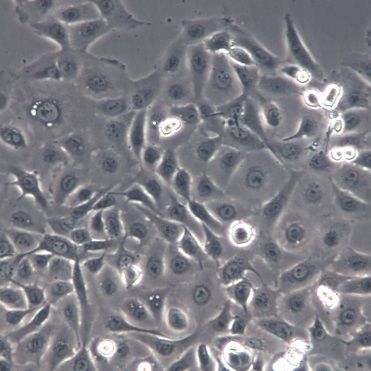 【NCI-H1650】NCI-H1650细胞/NCI-H1650细胞/NCI-H1650人非小细胞肺癌细胞
