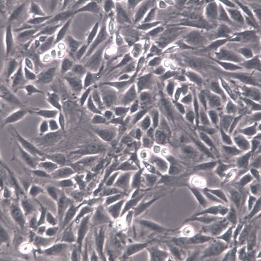 L6、L6细胞系、L6细胞株、L6大鼠成肌细胞[STR]