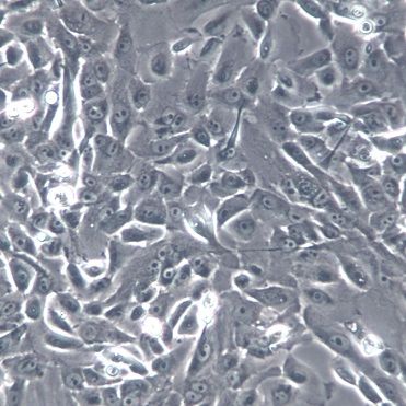 【MCF10A】MCF10A细胞/MCF10A细胞/MCF10A人正常乳腺上皮细胞
