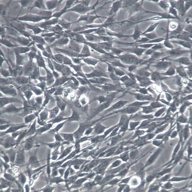 【HCMEC/D3】HCMEC/D3细胞/HCMEC/D3细胞/HCMEC/D3永生化人脑微血管内皮细胞