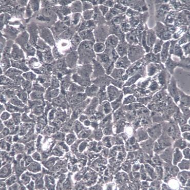 【CAOV-3】CAOV-3细胞/CAOV-3细胞/CAOV-3人乳头状卵巢腺癌细胞