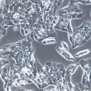 【MLTC-1】MLTC-1细胞/MLTC-1细胞/MLTC-1小鼠睾丸间质细胞瘤细胞