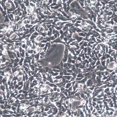 【P19】P19细胞/P19细胞/P19小鼠畸胎瘤细胞