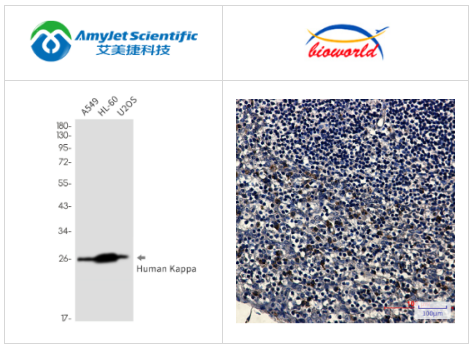 人κ轻链单克隆抗体丨艾美捷Bioworld解决方案