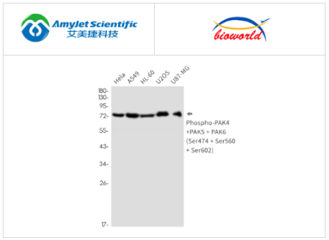 Bioworld磷酸化-PAK4/5/6单克隆抗体解决方案 Bioworld磷酸化-PAK4/5/6单克隆抗体解决方案
