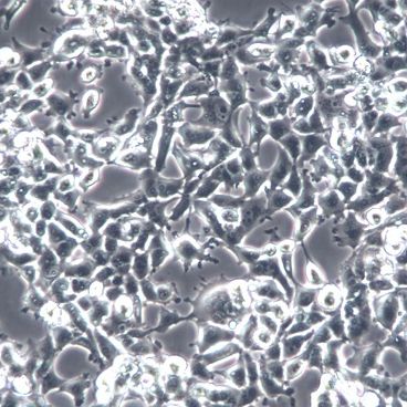 【95-D】95-D细胞/95-D细胞系/95-D细胞株/95-D人高转移肺癌细胞