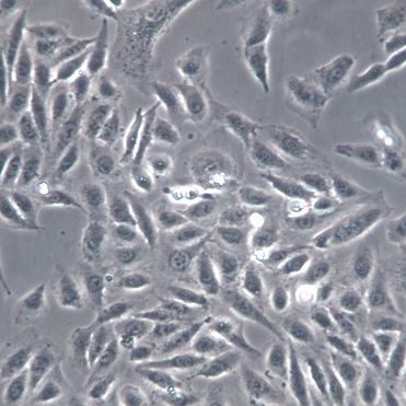 【TPC-1】TPC-1细胞/TPC-1细胞/TPC-1人甲状腺乳头状癌细胞株
