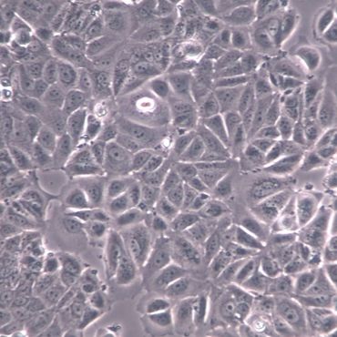 【MCF-7】MCF-7细胞/MCF-7细胞/MCF-7人乳腺癌细胞