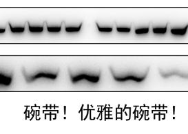 018.作者：dxy_lyd6tjj5