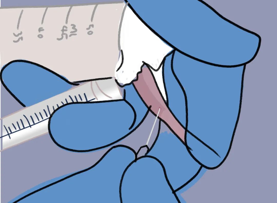 「一针见血」全靠这篇大小鼠采血秘籍