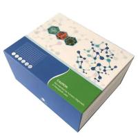 尿紫胆原(PBG)定性检测试剂盒(Watson-Schwartz法)|尿紫胆原定性测试盒