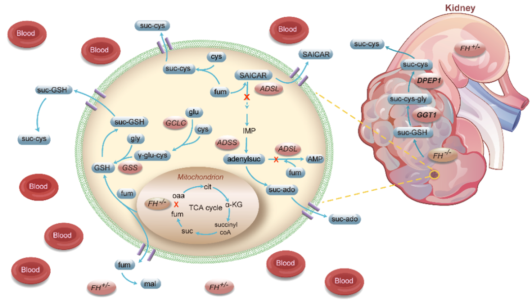 JCI 郑亮团队发现遗传性平滑肌瘤病和肾细胞癌综合征新型诊断和代谢机制