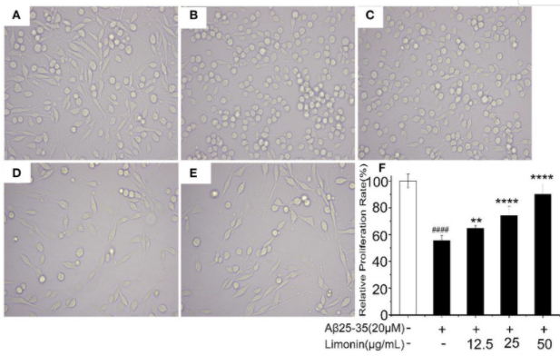 β-Amyloid (25-35)别名β-淀粉样蛋白(25-35)