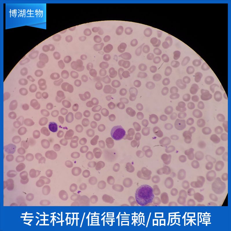 HEL人红白细胞白血病细胞
