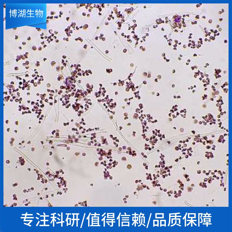 MOLT-4人急性淋巴母细胞白血病细胞