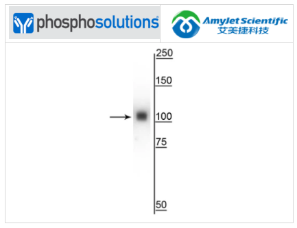 艾美捷Phosphosolutions抗α肌动蛋白4抗体解决方案 艾美捷Phosphosolutions抗α肌动蛋白4抗体解决方案