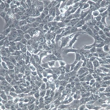 【4T1】4T1细胞/4T1细胞/4T1小鼠乳腺癌细胞