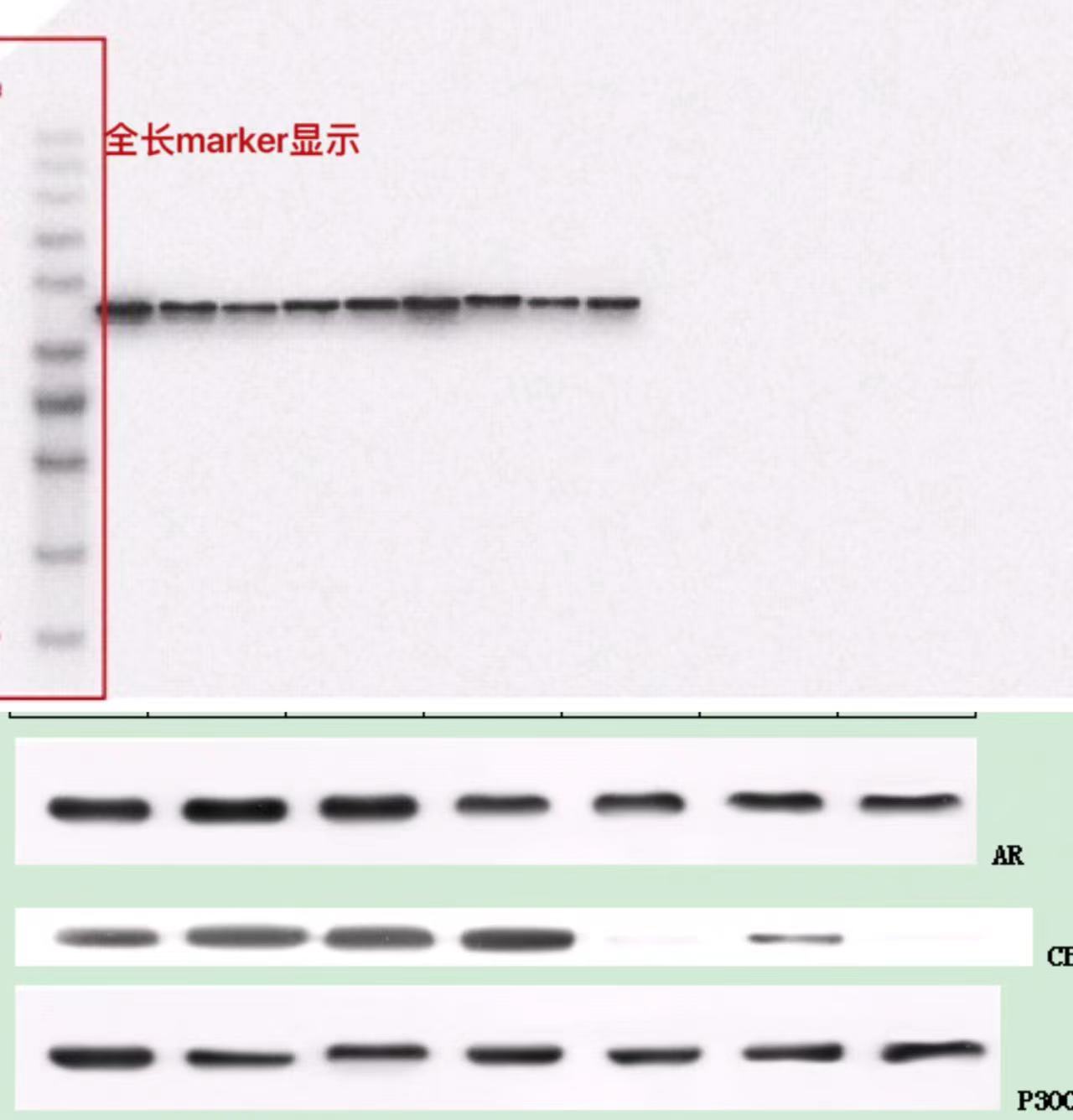 Western Blot技术服务，WB免疫印迹实验代测