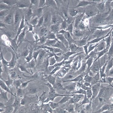 【MC3T3-E1  Subclone 14】MC3T3-E1  Subclone 14细胞/MC3T3-E1  Subclone 14细胞/MC3T3-E1  Subclone 14小鼠颅顶前骨细胞亚克隆14