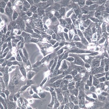 【ID8】ID8细胞/ID8细胞/ID8小鼠卵巢癌细胞