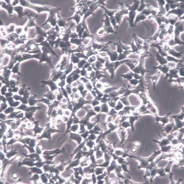 【293T】293T细胞/293T细胞/293T人胚肾细胞