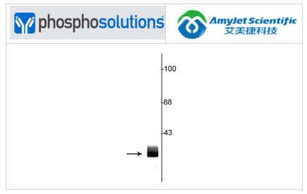艾美捷Phosphosolutions抗14-3-3蛋白抗体解决方案 艾美捷Phosphosolutions抗14-3-3蛋白抗体解决方案