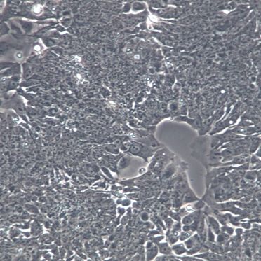 【T84】T84细胞/T84细胞/T84人结肠腺癌肺转移细胞