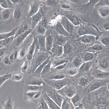 【CAKI-2】CAKI-2细胞/CAKI-2细胞/CAKI-2人肾透明细胞癌细胞