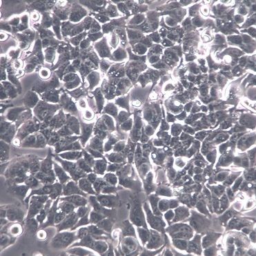 【HCCLM3】HCCLM3细胞/HCCLM3细胞/HCCLM3人高转移肝癌细胞