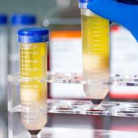 PBMC丨人外周血单个核细胞 | PBMC细胞 | 人外周血单个核细胞| PBMC细胞 | 人外周血单个核细胞