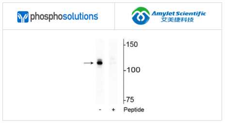 艾美捷Phosphosolutions抗雄激素受体 （Ser94） 抗体