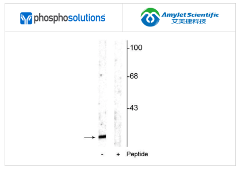 艾美捷Phosphosolutions抗α突触核蛋白(Ser129)抗体 艾美捷Phosphosolutions抗α突触核蛋白(Ser129)抗体