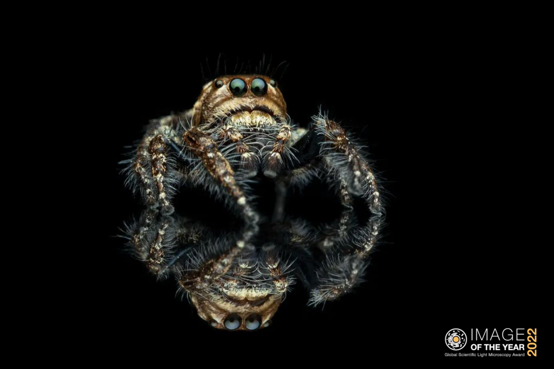 EVIDENT全球显微图像大赛全球大奖预测 奖品等您来拿！