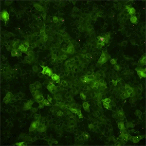 如何使用钙成像研究细胞信号转导|ibidi实验应用