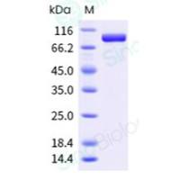 重组小鼠 Hsp90 alpha 蛋白 (全长) (His 标签)