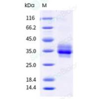 重组小鼠 CLEC12A 蛋白 (His 标签)