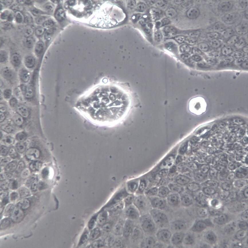 【Capan-2】Capan-2细胞/Capan-2细胞/Capan-2人胰腺癌细胞