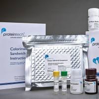 UBE2S Polyclonal antibody