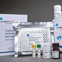 CPS1 Polyclonal antibody