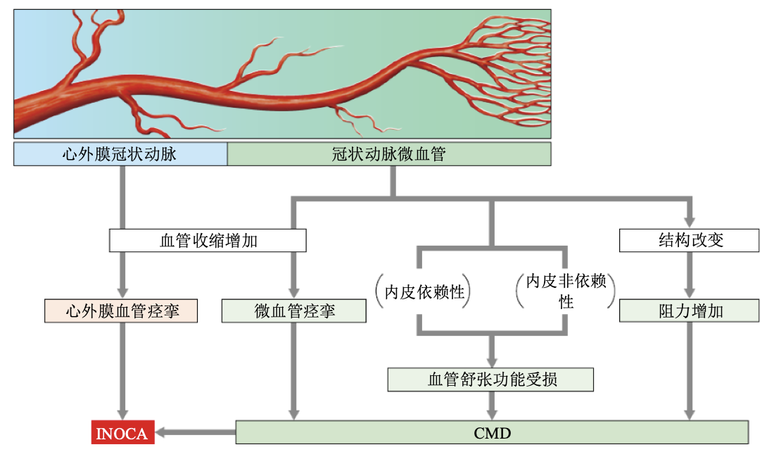 血管痉挛性心绞痛