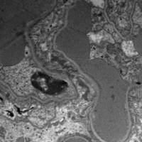 透射电镜实验服务