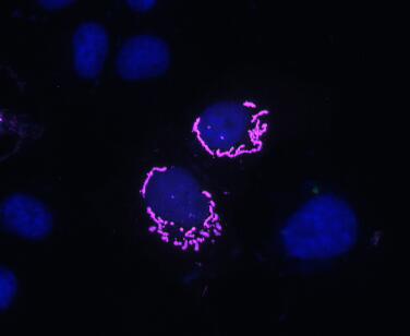上海宇北医疗器械有限公司成为Nanotag渠道代理销售商