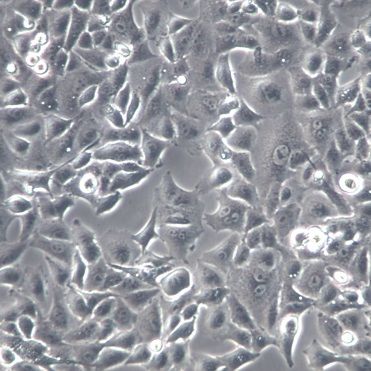 【A549】A549细胞/A549细胞/A549人非小细胞肺癌细胞