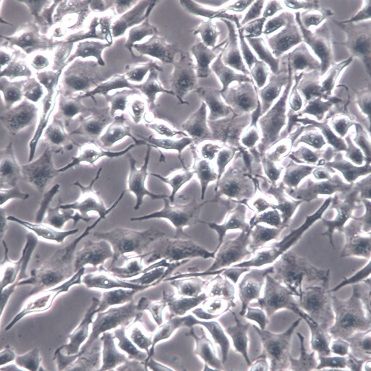 【RD】RD细胞/RD细胞/RD人恶性胚胎横纹肌瘤细胞