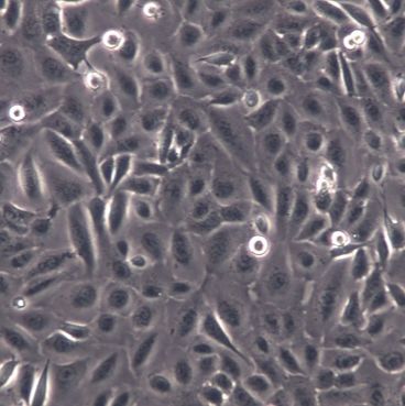 【DU145】DU145细胞/DU145细胞/DU145人前列腺癌细胞