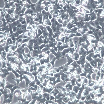 【ins-1】ins-1细胞/ins-1细胞/ins-1大鼠胰岛细胞瘤细胞