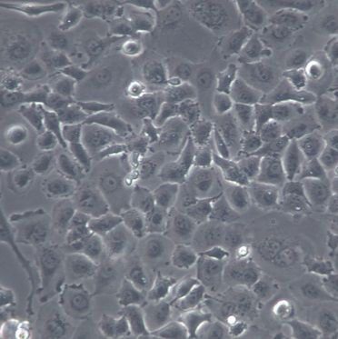 【NCI-H23】NCI-H23细胞/NCI-H23细胞/NCI-H23人非小细胞肺癌细胞