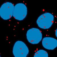 病理定量阳性率分析